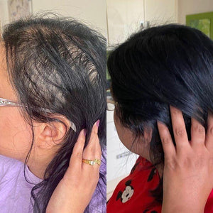 FEG - Spray de Crescimento Capilar